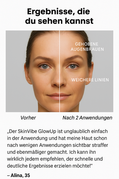SkinVibe GlowUp™