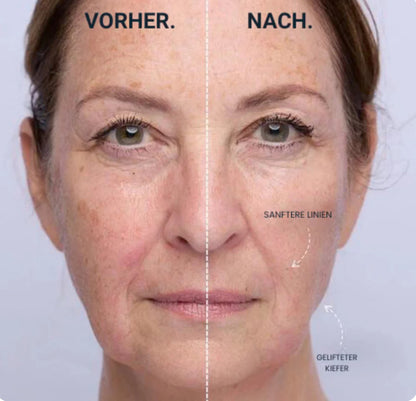 SkinVibe LumiLift™